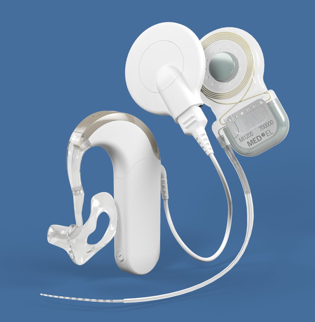 Día Internacional del Implante Coclear FASOCIDE